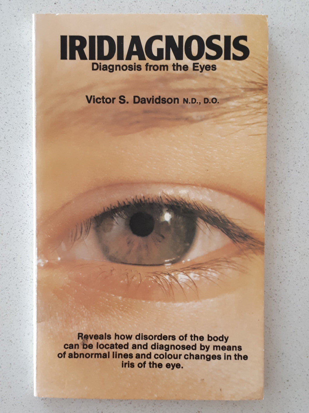 Iridiagnosis by Victor S. Davidson