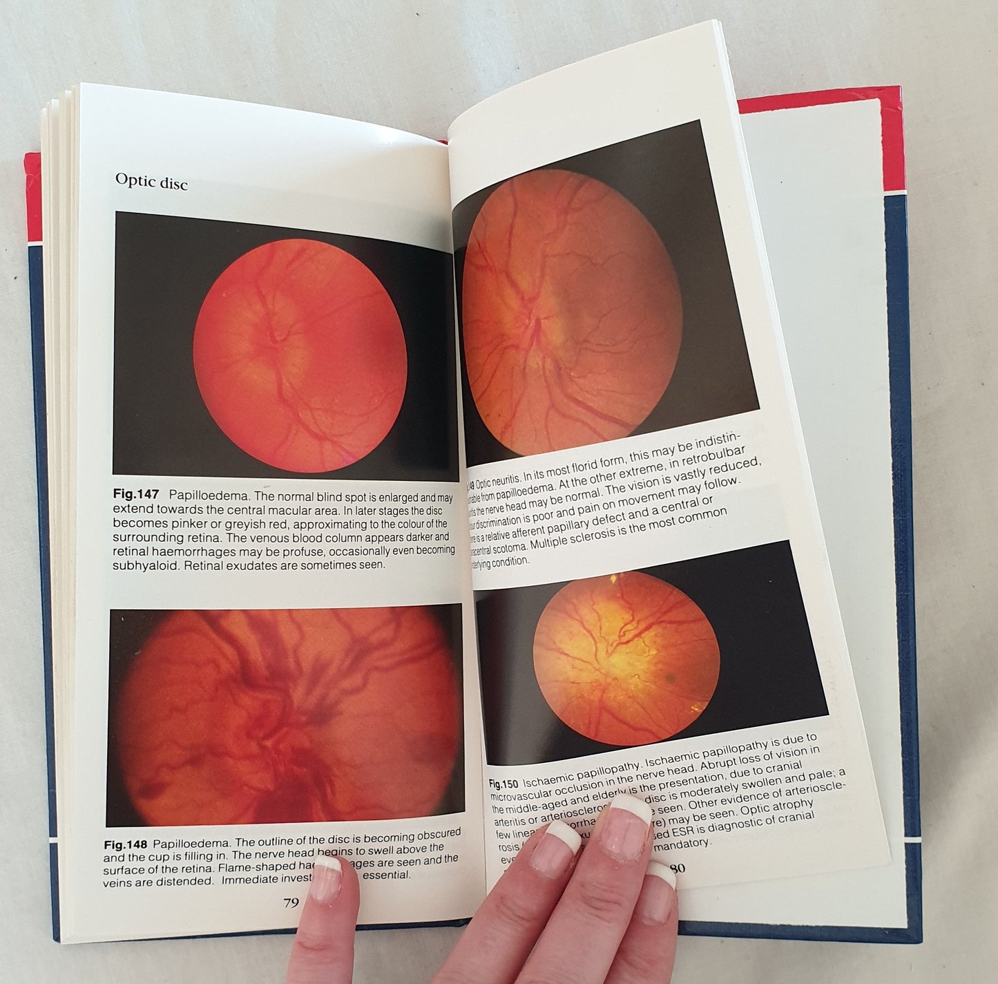 Ophthalmology by Colin M. Kirkness