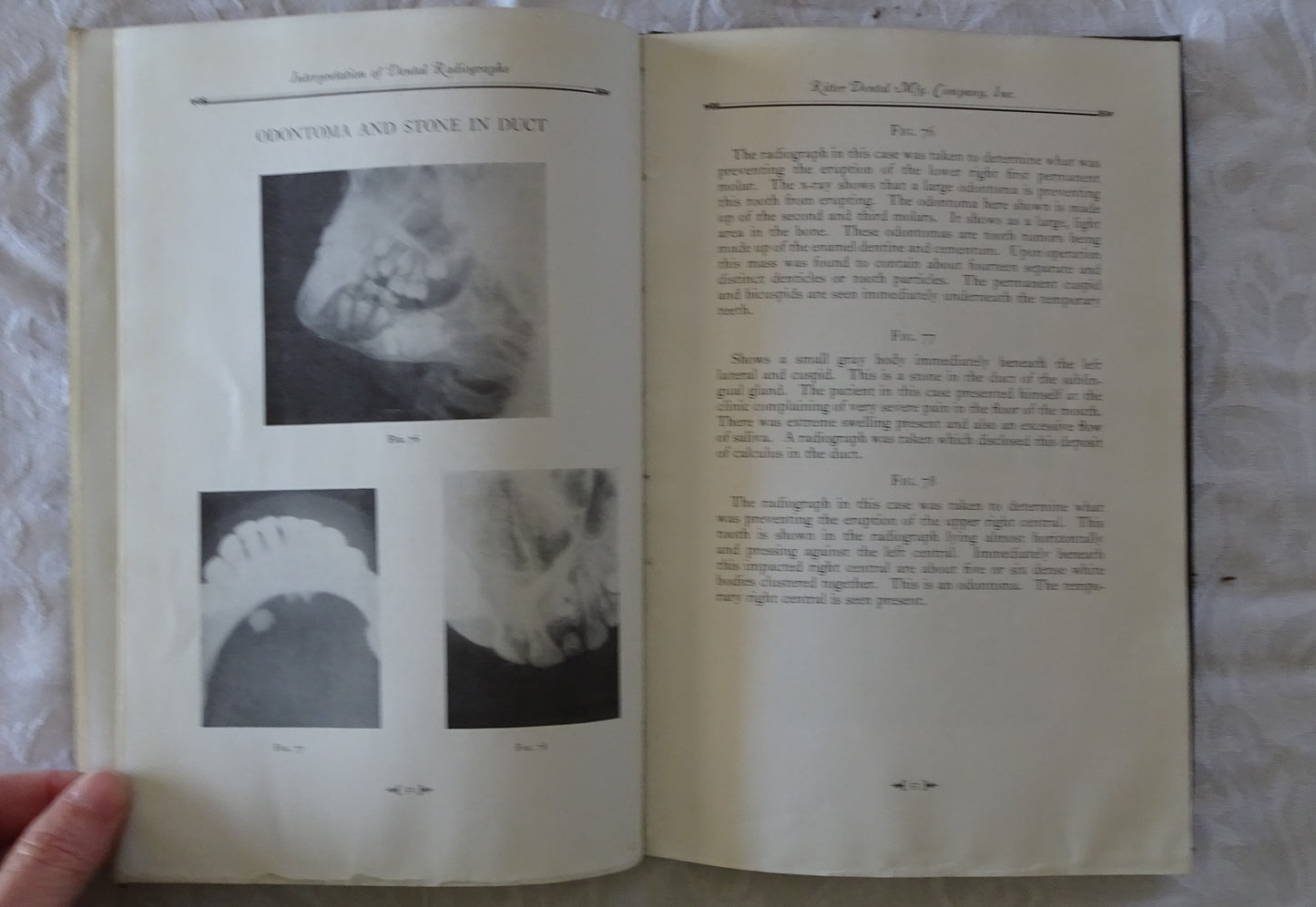 Interpretation of Dental Radiographs by A. L. Greenfield